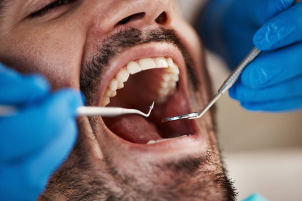 Best Root Canal Emergency Dentist  in Lovington, IL