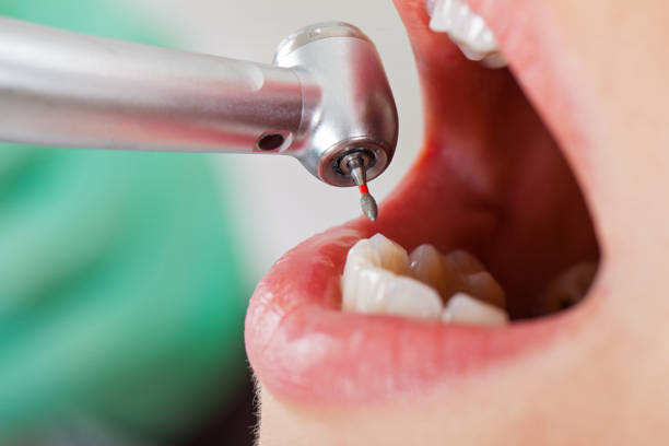 Best Emergency Tooth Extraction  in Lovington, IL